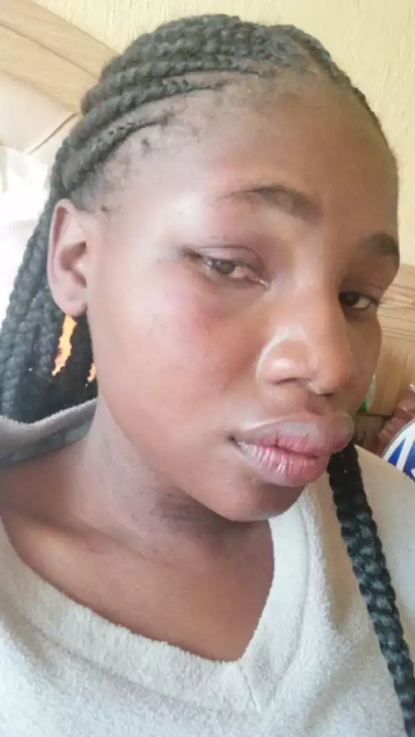 Lady In Shock After A Trusted Neighbour Raped Her In South Africa (Photos)